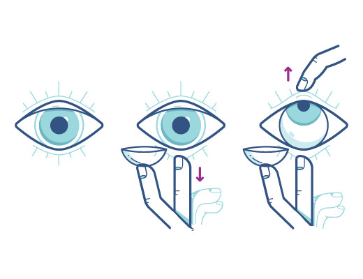 Grafische Anleitung in 3 Bildern zum richtigen Einsetzen von Kontaktlinsen.